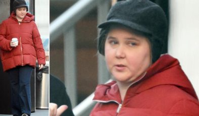 Herkes ünlü yıldızın yüzüyle alay etmişti: Altından ciddi bir hastalık çıktı