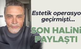 Estetik operasyon geçirmişti… Son halini paylaştı