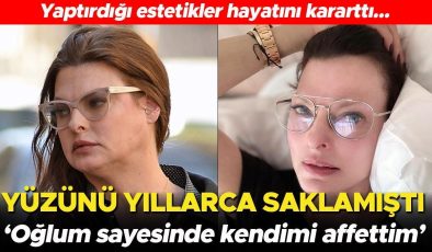 Yaptırdığı estetikler hayatını karartmıştı… Yıllarca yüzünü herkesten sakladı: Oğlum sayesinde artık kendimi affettim