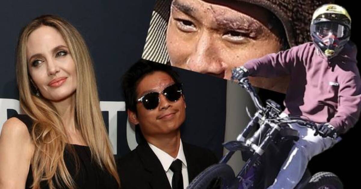 Angelina Jolie ve Brad Pitt’in oğlu Pax’in geçirdiği kaza yüzünde derin bir iz bıraktı