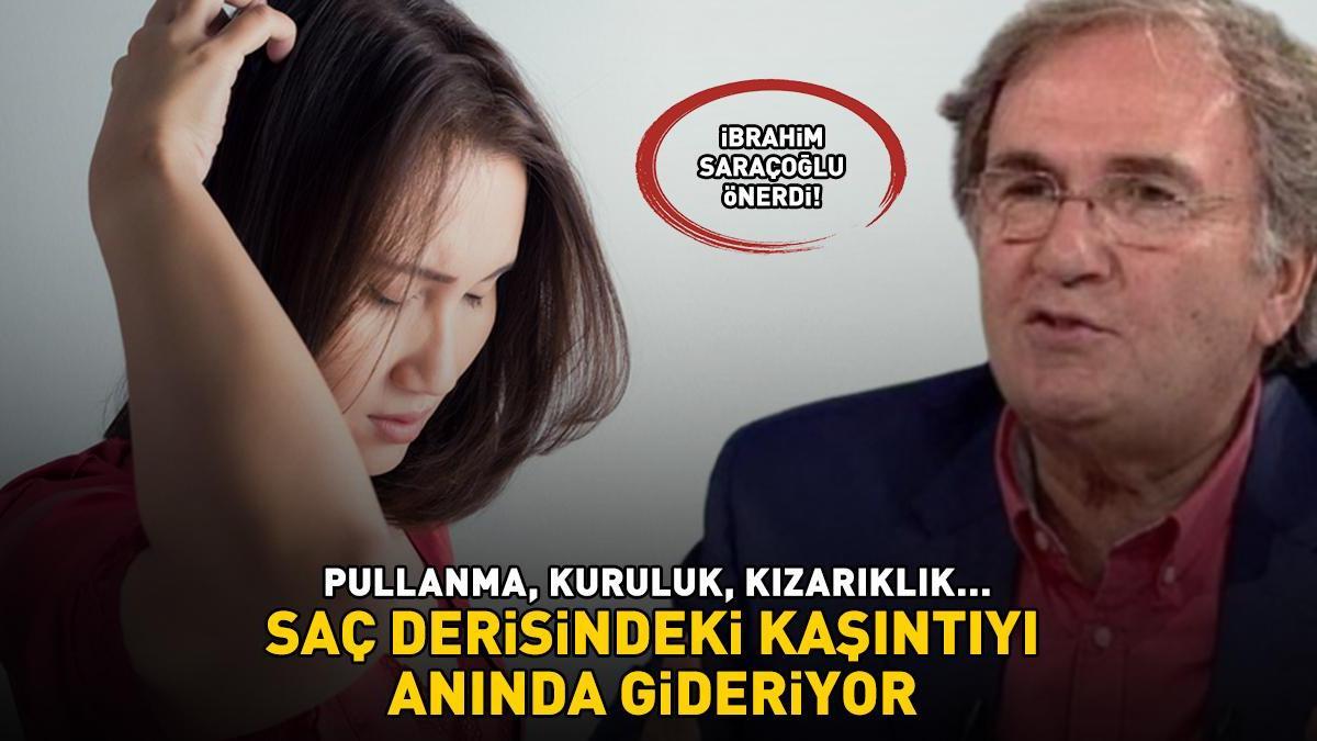SAÇ EGZAMASI KABUSUNUZ OLMASIN! Pullanma, kuruluk, kızarıklık… İbrahim Saraçoğlu önerdi! Saç derisindeki kaşıntıyı hafifletiyor